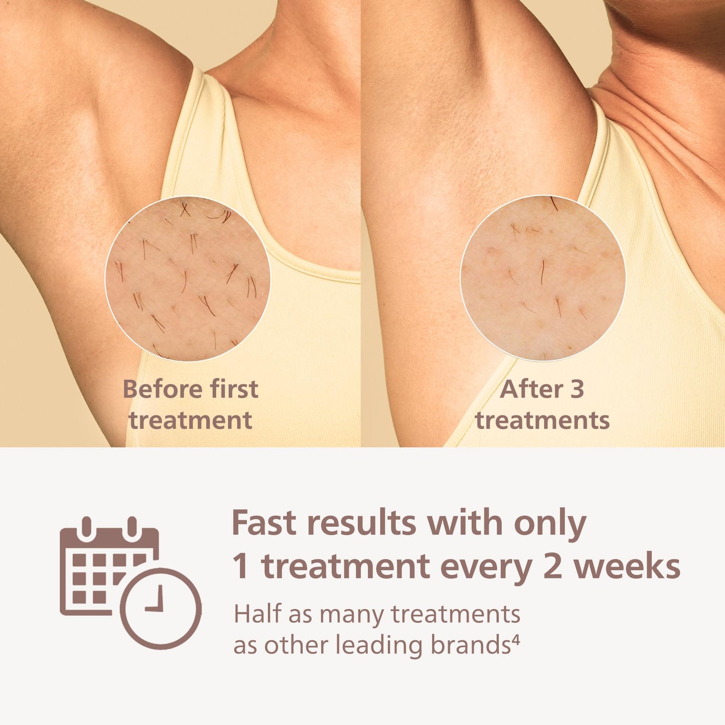 Philips Lumea 9000 IPL Hair Removal Device SenseIQ 4 Attachments BRI984