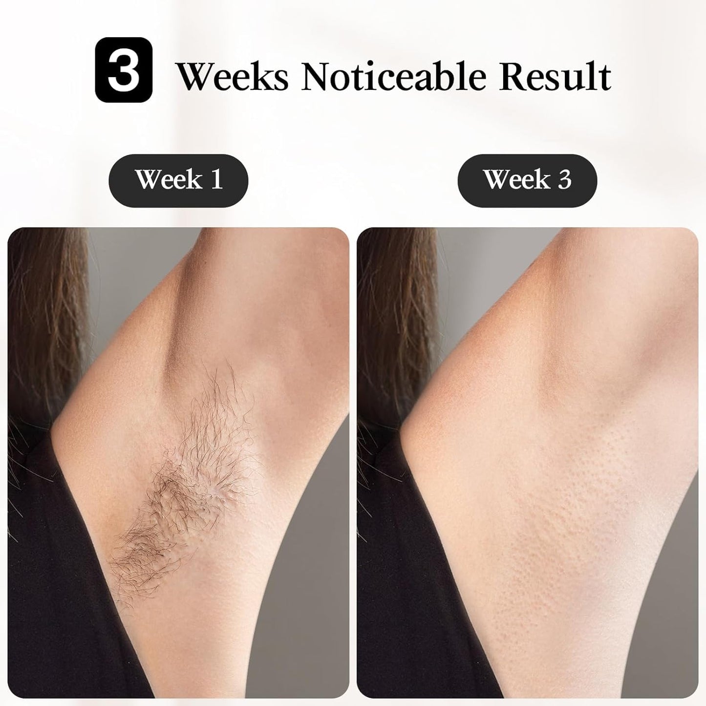 JOVS IPL Hair Removal Device Ice Cooling Painless Laser Hair Removal 6 Modes