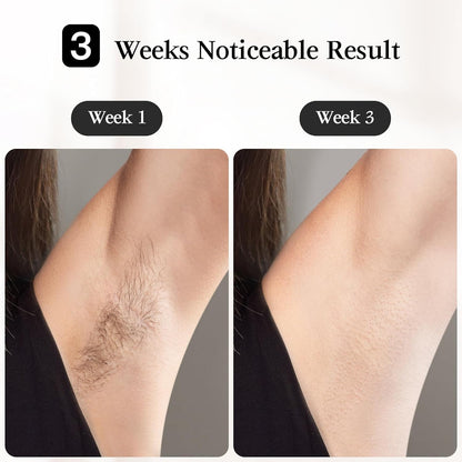 JOVS IPL Hair Removal Device Ice Cooling Painless Laser Hair Removal 6 Modes