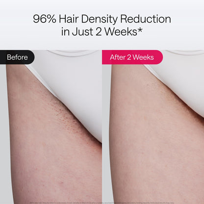Ulike Air 10 IPL Hair Removal Device Ice Cooling Skin Sensor Permanent Hair Removal