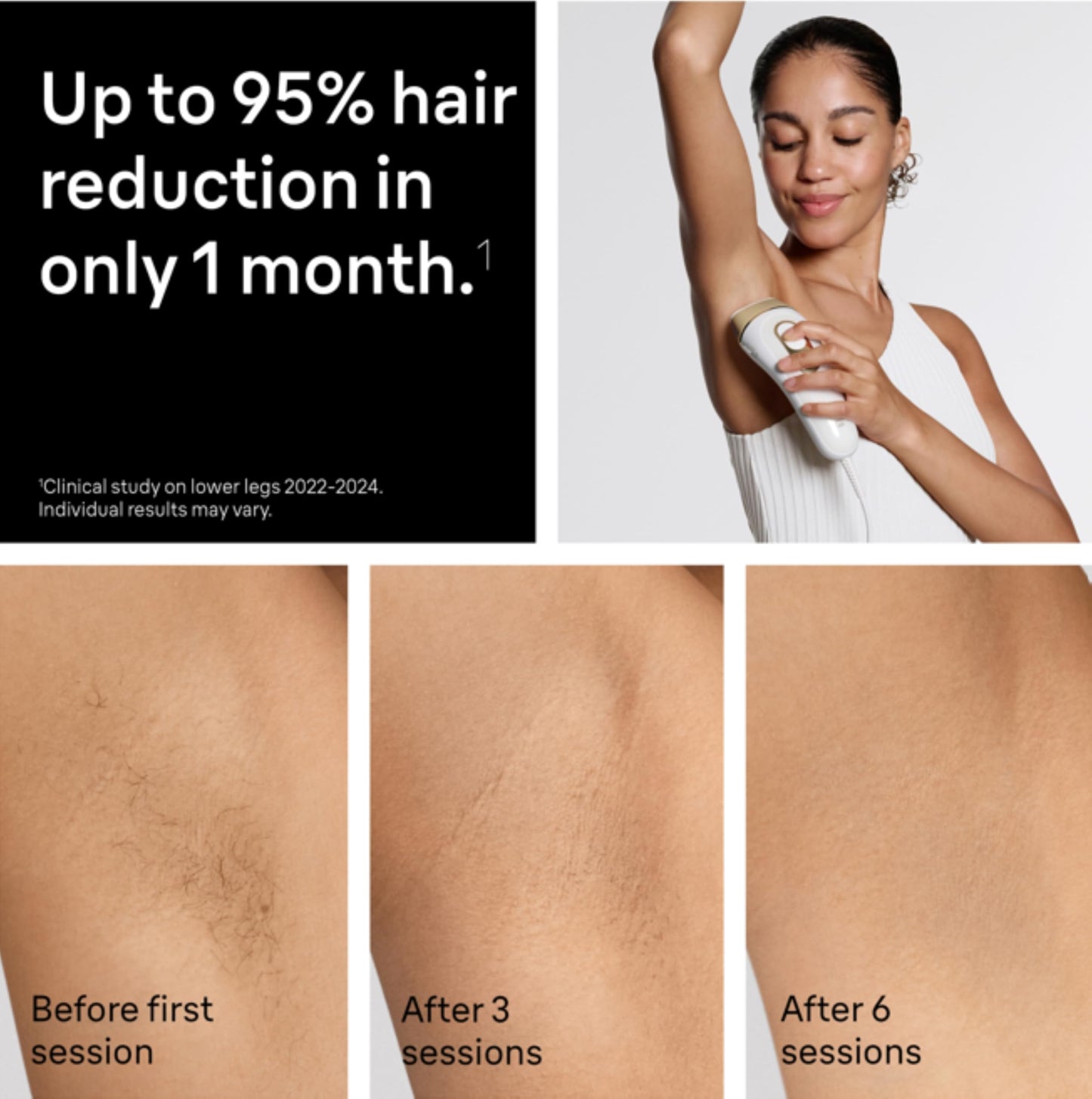 Braun Silk Expert Pro 5 IPL Hair Removal Device 2 Heads Venus Razor IPL5157